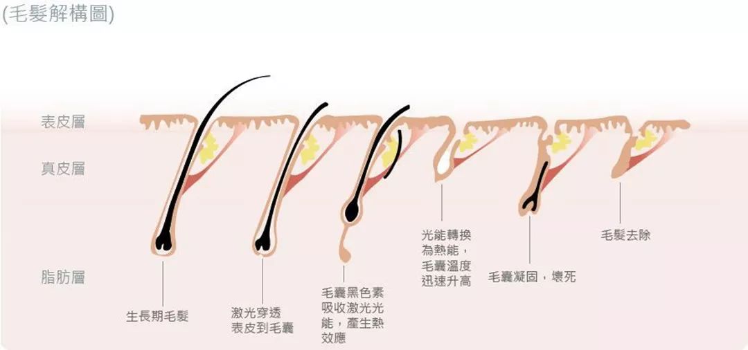 “白煮蛋”與“獼猴桃”之間，還差一個(gè)它 強(qiáng)脈沖脫毛器械，值得買嗎？